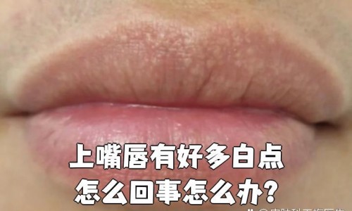 小金鱼身上溃烂尾巴吊网 - 网站提供小金鱼烂尾巴怎么治疗小常识、金鱼烂身烂尾用什么药治疗好